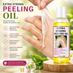 OUHOE OU012211287 Extra Strong Peeling Oil 110ml – Exfoliating Skin Renewal Oil for Dead Skin Removal, Smooth & Radiant Skin