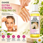 OUHOE OU012211287 Extra Strong Peeling Oil 110ml – Exfoliating Skin Renewal Oil for Dead Skin Removal, Smooth & Radiant Skin