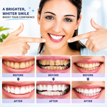 Oralhoe Nicotinamide Dazzle White Toothpaste – Teeth Whitening & Fresh Breath | 100g